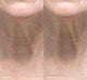 The under chin area of a mature person before and after using FarmHouse Fresh Necks-Level Smooth Neck Cream, demonstrating the visible improvement in the look of wrinkles.