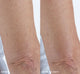 An arm before and after using FarmHouse Fresh Smooth Reveal Resurfacing Silky Serum, showing significant visible difference and improvement of rough skin and wrinkles.