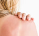 A woman is showing her sunburnt shoulder before applying FarmHouse Fresh Ahhhsome Relief Foam-to-Oil After Sun Body Mousse.