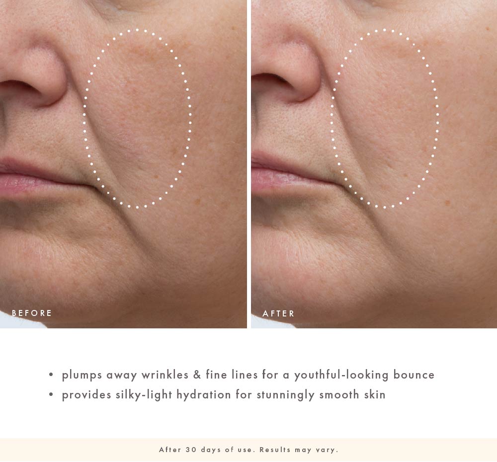 Cactus Cloudsilk before-and-after image showing plumper-looking skin, softened wrinkles, and smoother texture