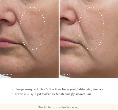 Cactus Cloudsilk before-and-after image showing plumper-looking skin, softened wrinkles, and smoother texture