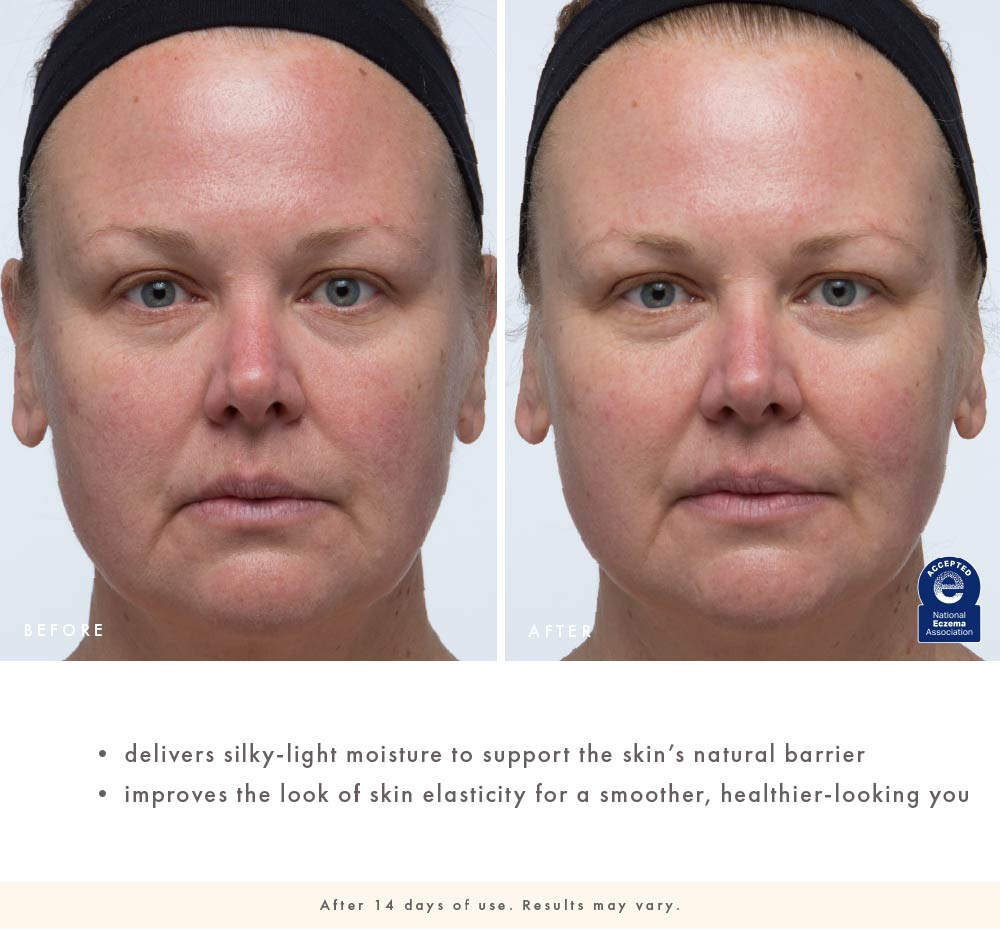 Before-and-after face close-up showing smoother, healthier-looking skin after 14 days of Cactus Comfort use
