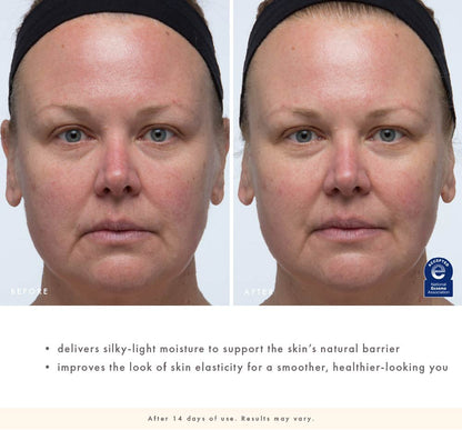 Before-and-after face close-up showing smoother, healthier-looking skin after 14 days of Cactus Comfort use