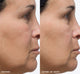 Side of a woman’s face before and after using FarmHouse Fresh Sunflower Superbalm Firming Peptide Boost face balm, showing significant difference and improvement in the look of fine lines.