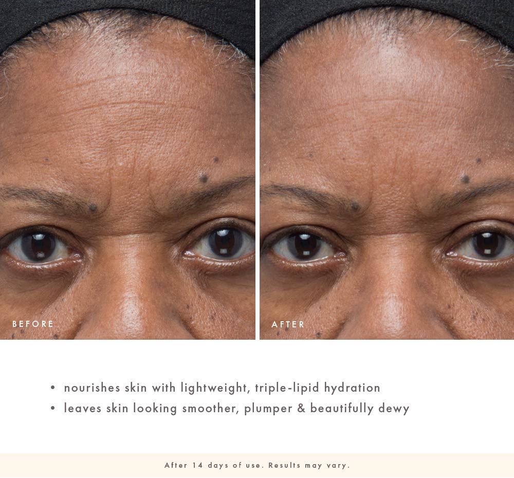 Before-and-after eye and forehead close-up showing smoother, plumper-looking skin after 14 days of Dew Ritual use