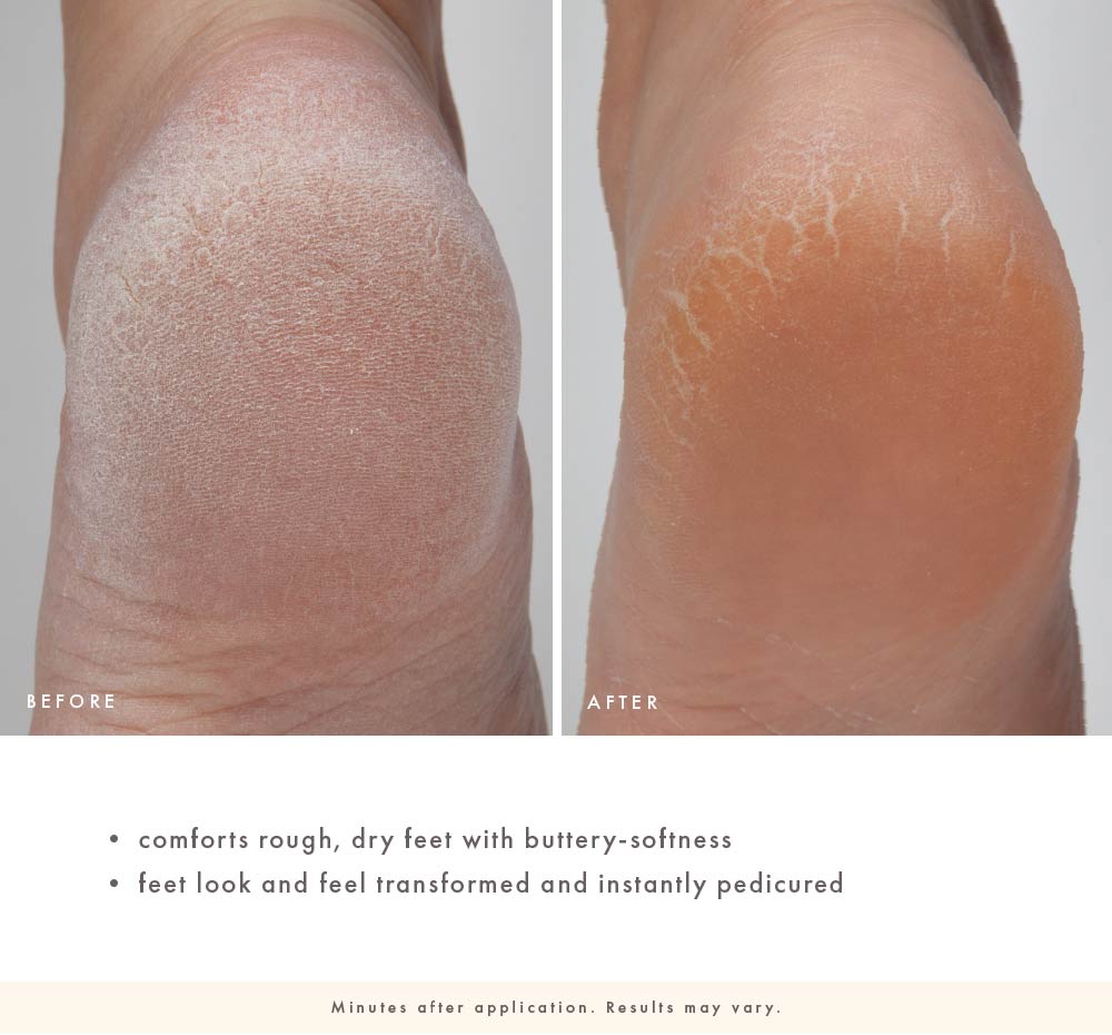 Enrich Mint® Foot Rescue Mask – FarmHouse Fresh