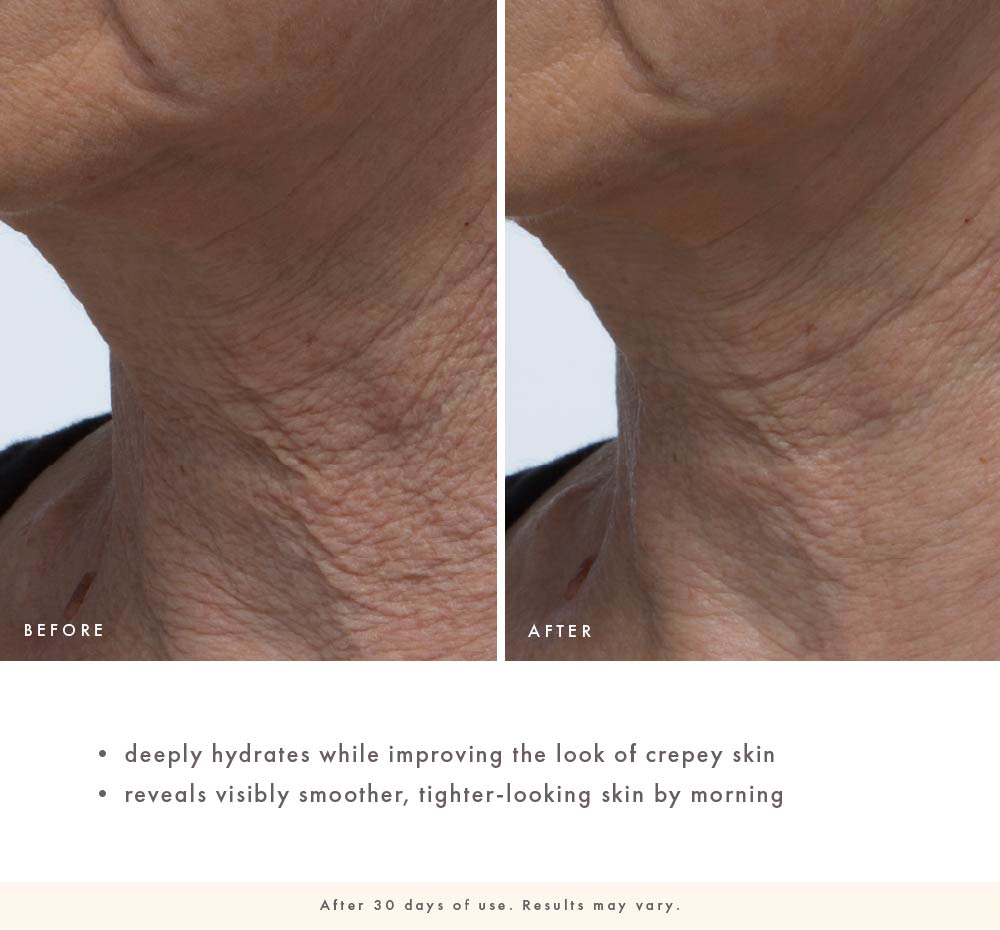 Before-and-after neck close-up showing smoother, tighter-looking skin with improved crepey texture after 30 days of Evening Rose use