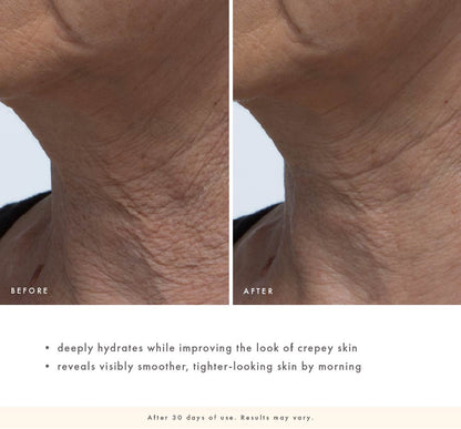 Before-and-after neck close-up showing smoother, tighter-looking skin with improved crepey texture after 30 days of Evening Rose use