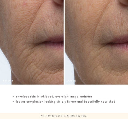 Before-and-after lower face close-up showing smoother-looking skin around the mouth and chin after 30 days of Evening Rose use
