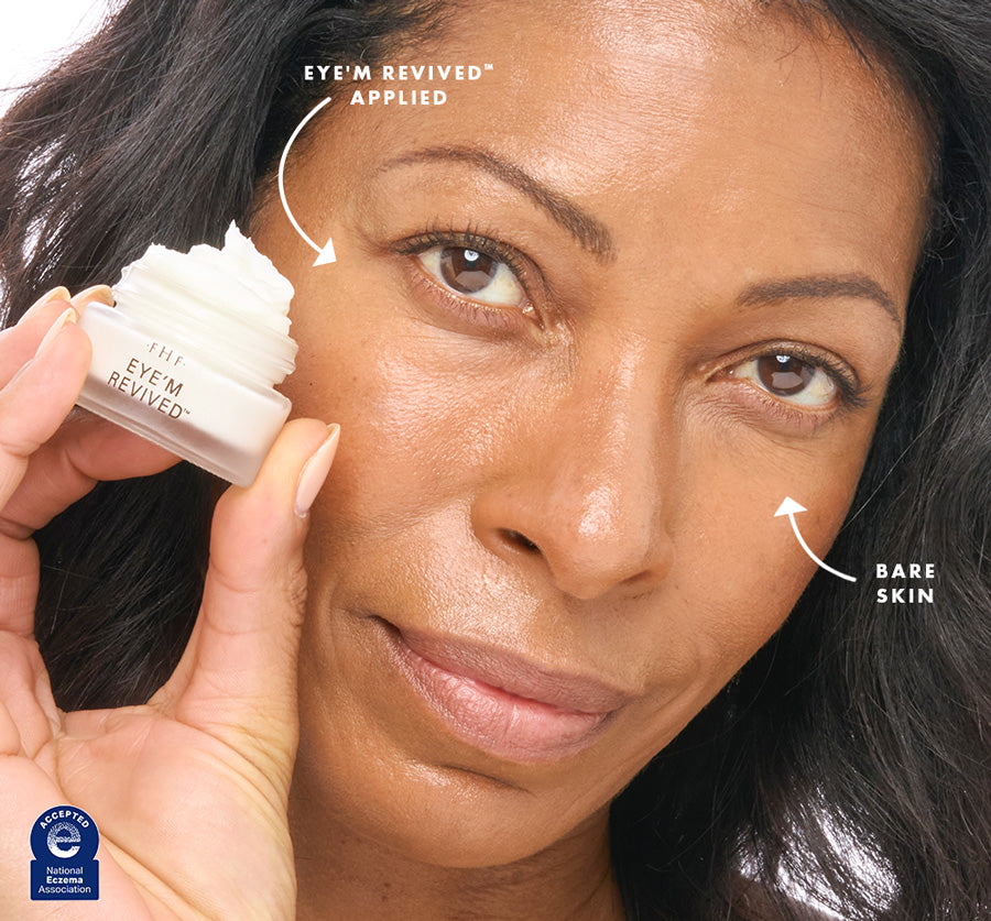 Before and after comparison of under-eye area with visible instant hydration after using Eye'm Revived.
