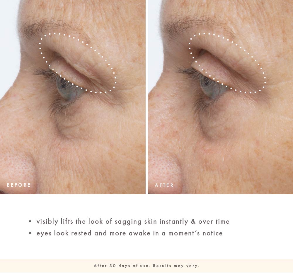 Before-and-after upper eye-area close-up showing visibly lifted-looking eyelid skin after 30 days of Firm-Tastic Eyes use