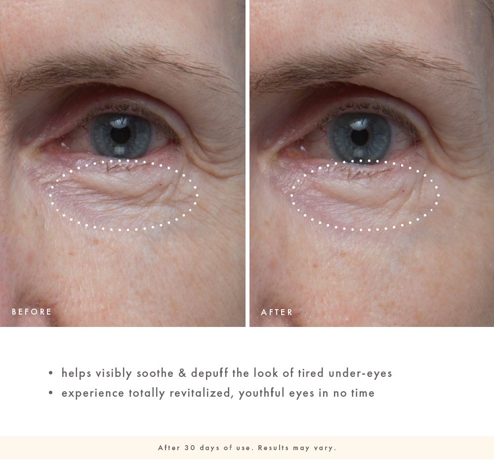 Before-and-after under-eye close-up showing smoother-looking skin and less puffy-looking under-eyes after 30 days of Firm-Tastic Eyes use