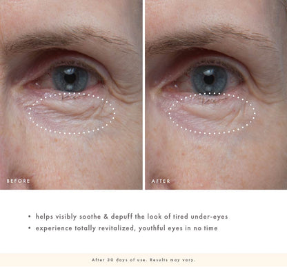 Before-and-after under-eye close-up showing smoother-looking skin and less puffy-looking under-eyes after 30 days of Firm-Tastic Eyes use