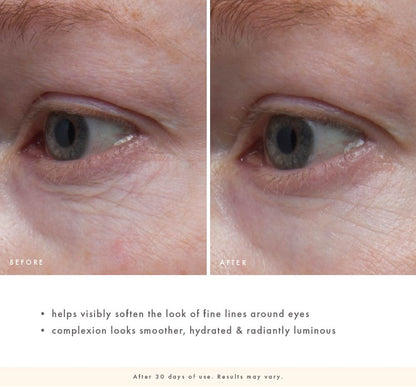 FarmHouse Fresh Lustre Rose before-and-after close-up of under-eye area showing the appearance of softened fine lines and a smoother, more hydrated, radiant look after 30 days of use