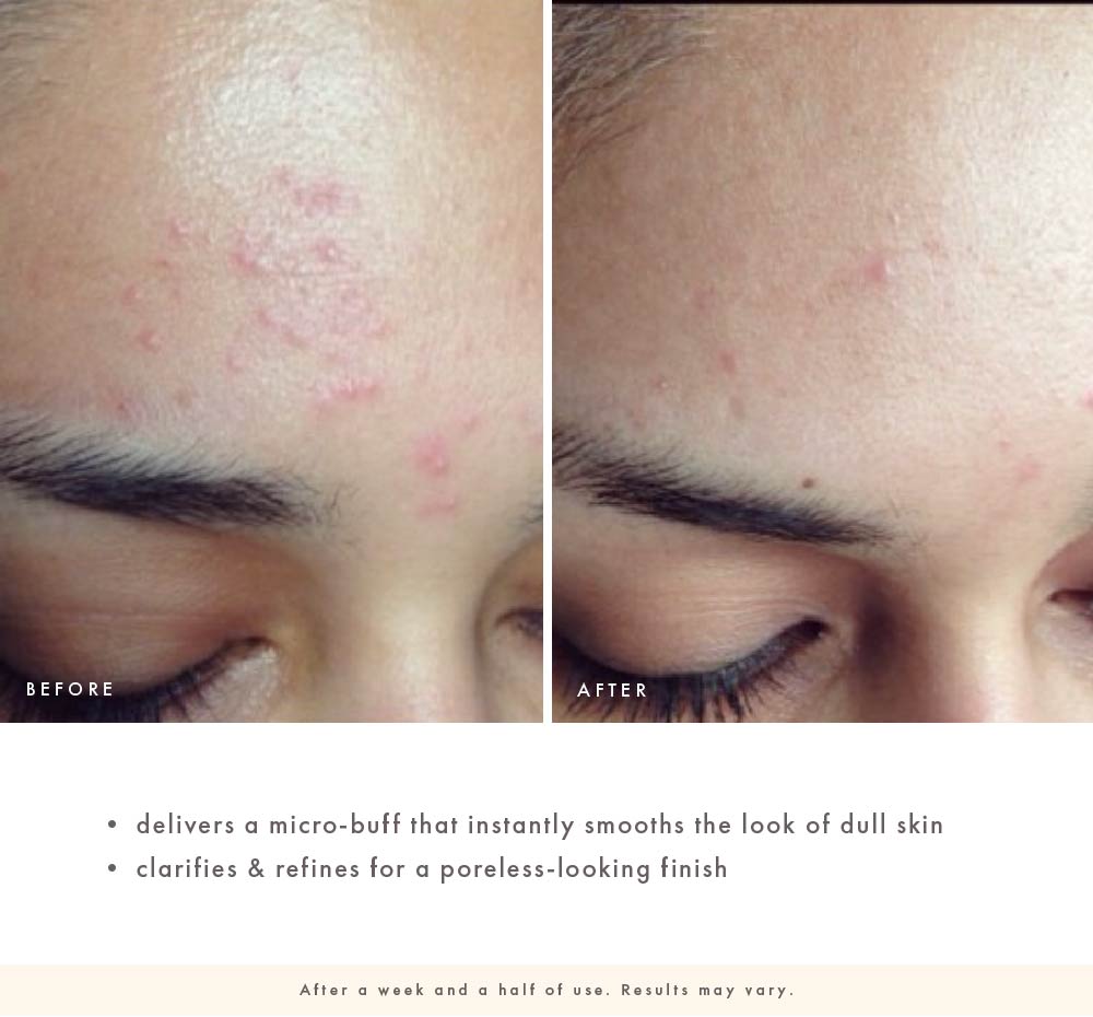 Lora Arellano features Farmhouse Fresh Sanded Ground Clarifying Mud Exfoliation Mask on her Instagram page, showing how it helped her get rid of breakouts after about a week of use.