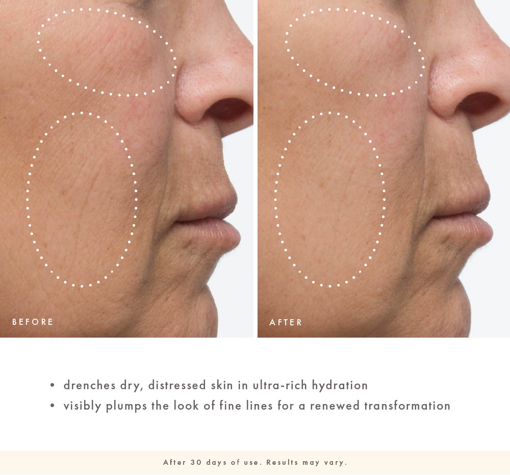 FarmHouse Fresh Sunflower Superbalm before-and-after close-up of cheek and smile-line area showing skin appearing smoother, more hydrated, and visibly plumper after 30 days of use