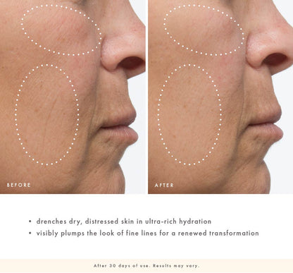 FarmHouse Fresh Sunflower Superbalm before-and-after close-up of cheek and smile-line area showing skin appearing smoother, more hydrated, and visibly plumper after 30 days of use