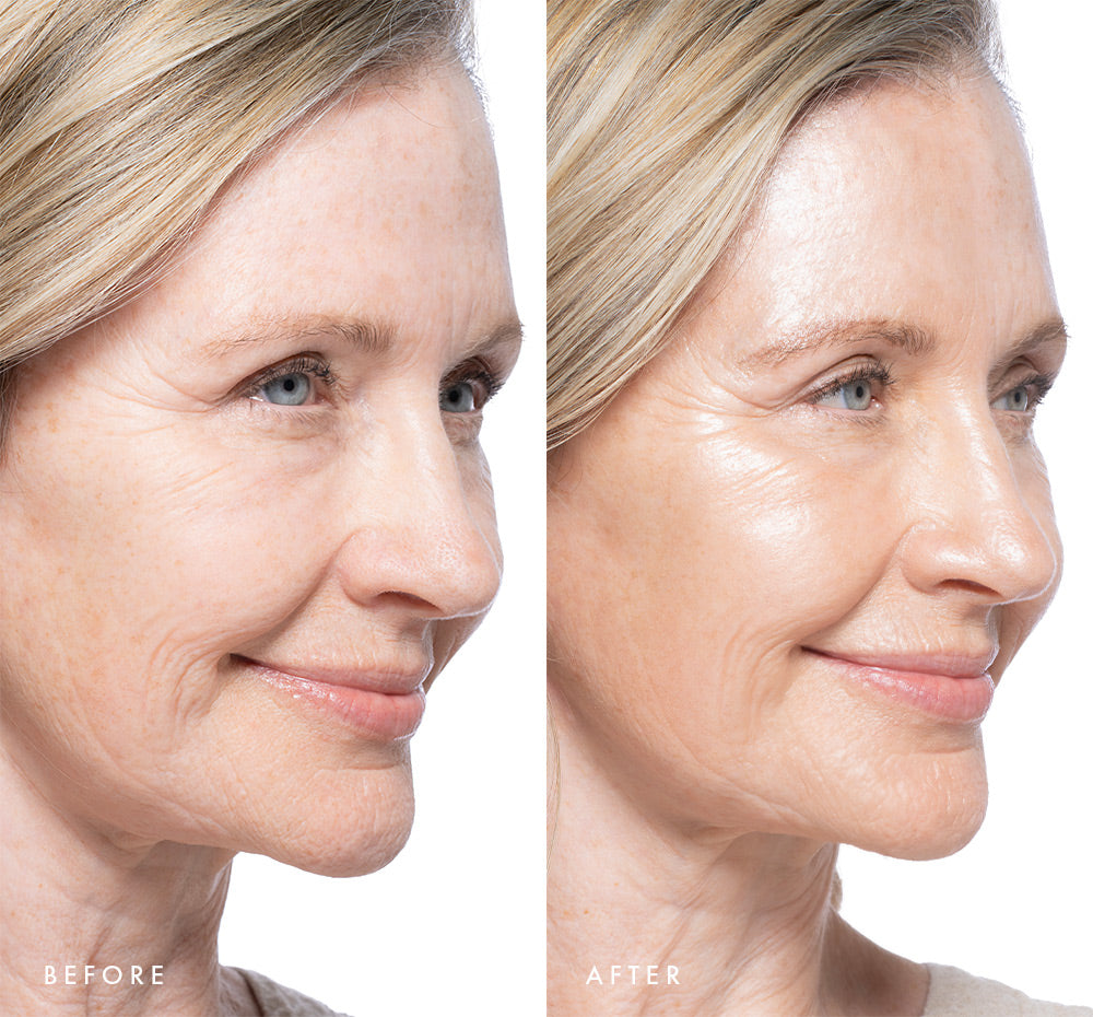 Before and after comparison of a woman's face with visible glow on skin using Tint-sational Sheer Skin-Perfecting Serum using shade Barely Beige