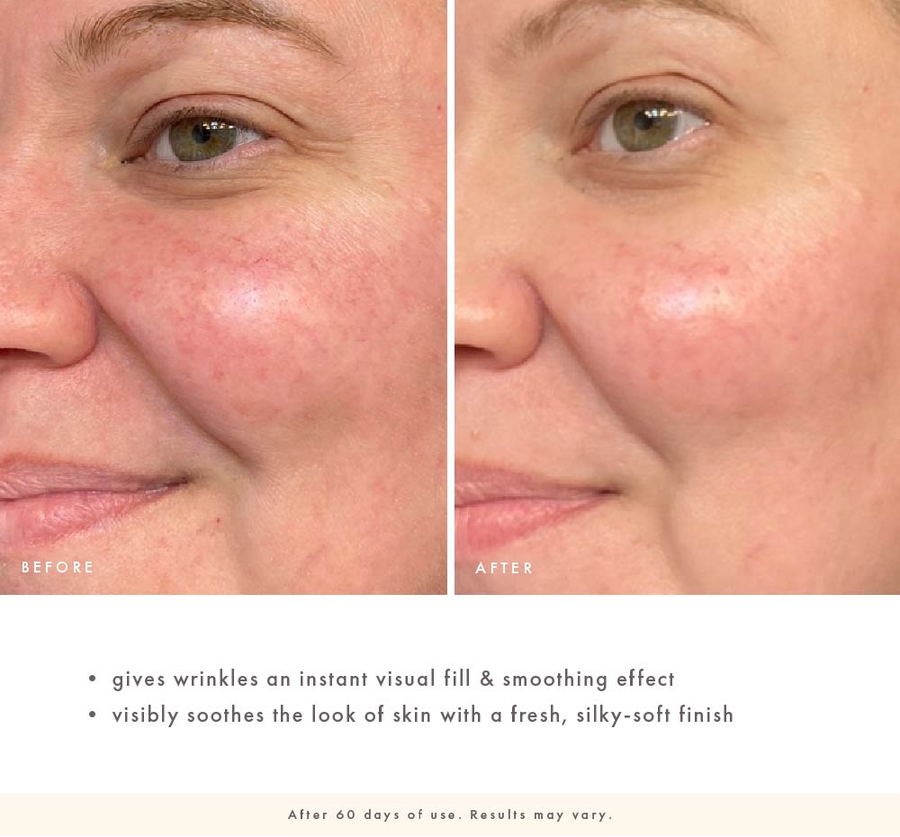 FarmHouse Fresh Watermelonaid before-and-after cheek close-up showing smoother-looking skin, softened fine lines, and a calmer, silky-soft appearance after 60 days of use