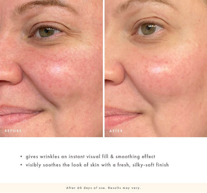 FarmHouse Fresh Watermelonaid before-and-after cheek close-up showing smoother-looking skin, softened fine lines, and a calmer, silky-soft appearance after 60 days of use