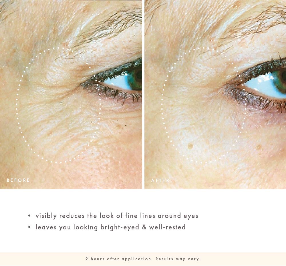 FarmHouse Fresh Wine Down before-and-after close-up of eye area showing the look of reduced fine lines and a brighter, more rested appearance two hours after application