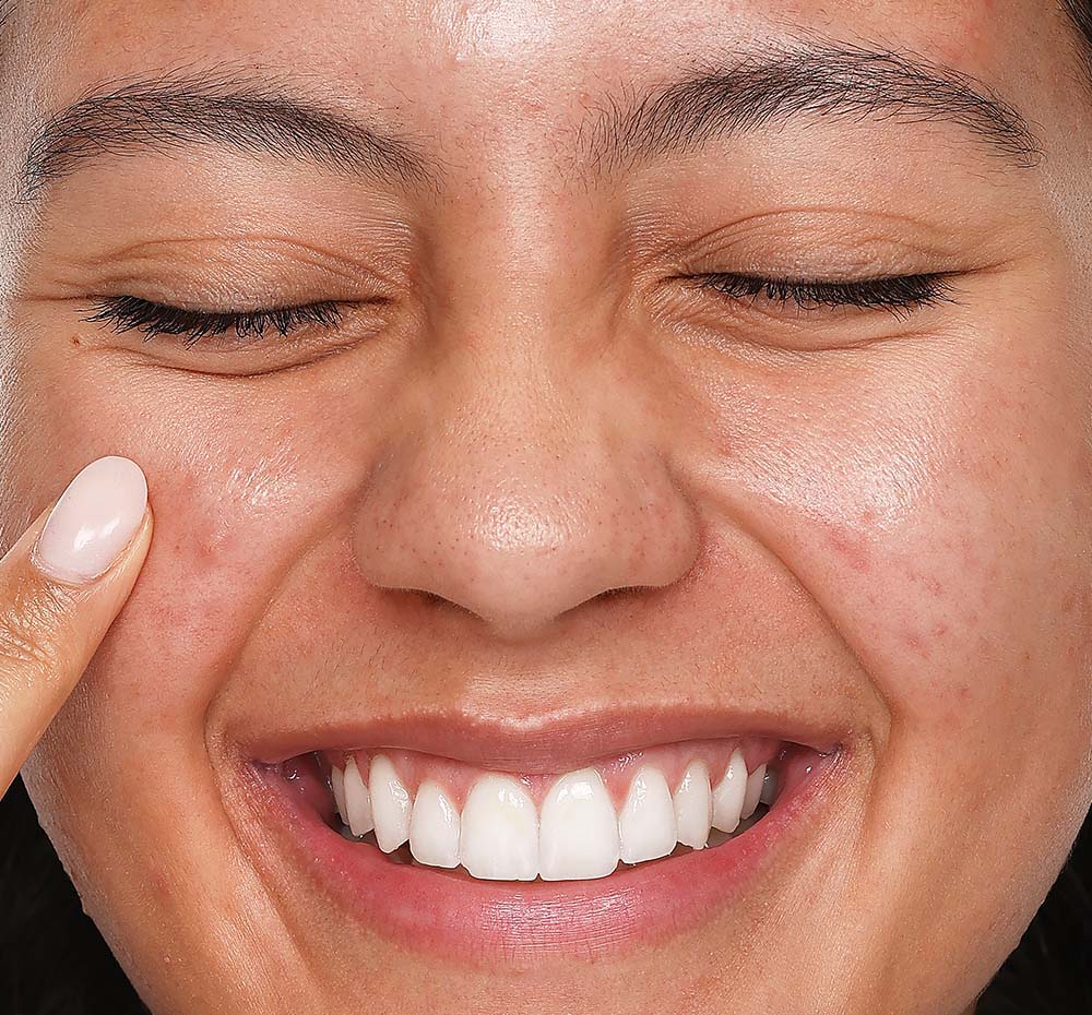 A woman is applying FarmHouse Fresh Day Breakthru Day Serum acne treatment on her face to help calm visible irritation.