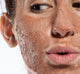 A woman with Farmhouse Fresh Sanded Ground exfoliating face Mask on her face, a staple skincare product to clear acne.