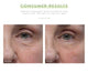 Under eye area of the same person, showing before and after results of using FarmHouse Fresh Sunflower Superbalm face balm boosted by Thyme Swipe Balancing Peel Pads, showing significant improvement in the look of wrinkles.